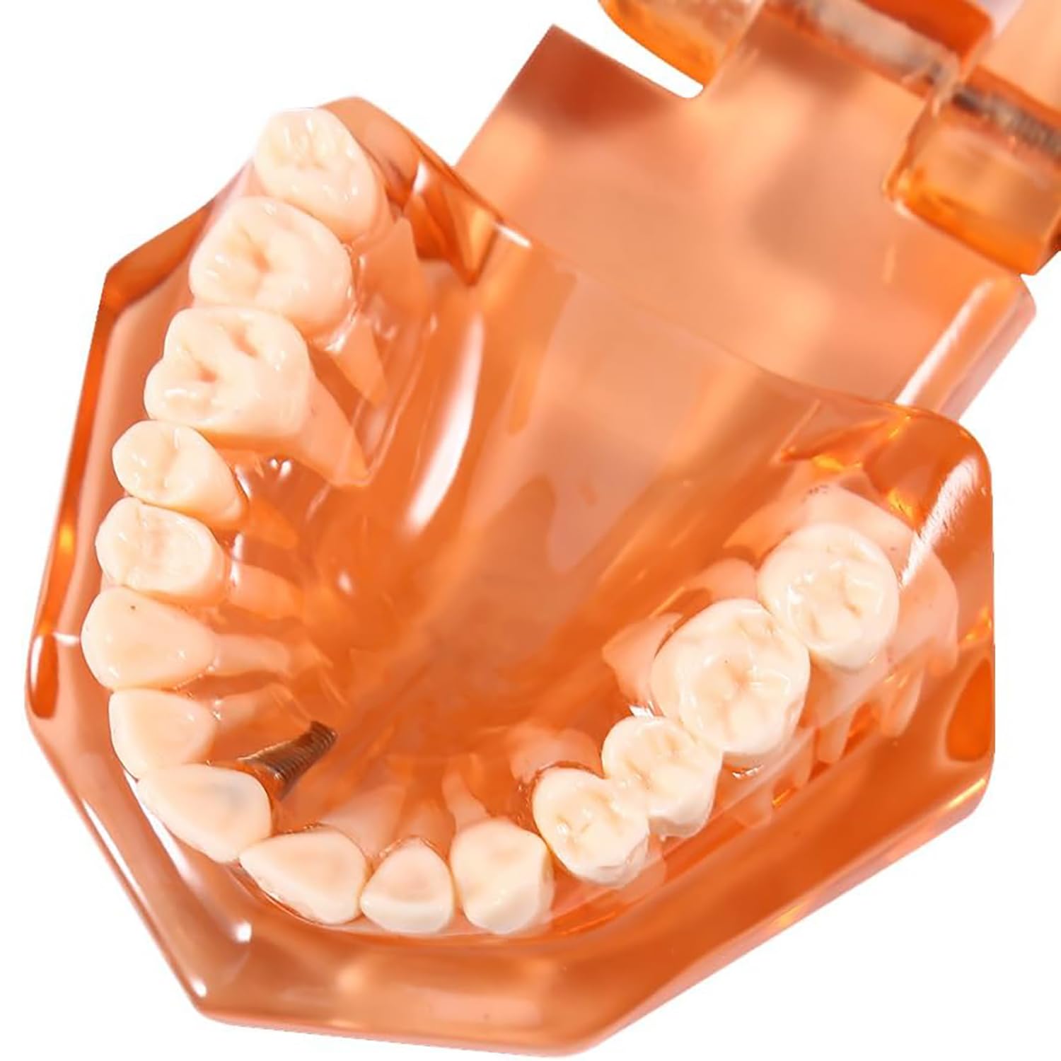Pomarańczowy zdejmowany model zębów dentystycznych, model dentystyczny, nauczanie chorób zębów, model zębów implantologicznych, do komunikacji lekarz-pacjent