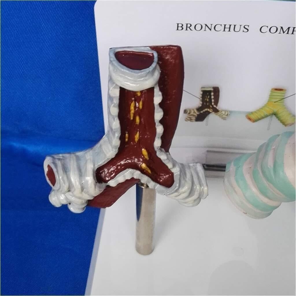 Human Trachea Anatomy Model, Smoking Trachea and Normal Trachea Comparison Model, Respiratory System Structure Organ Anatomy, for Medical Teaching Display.