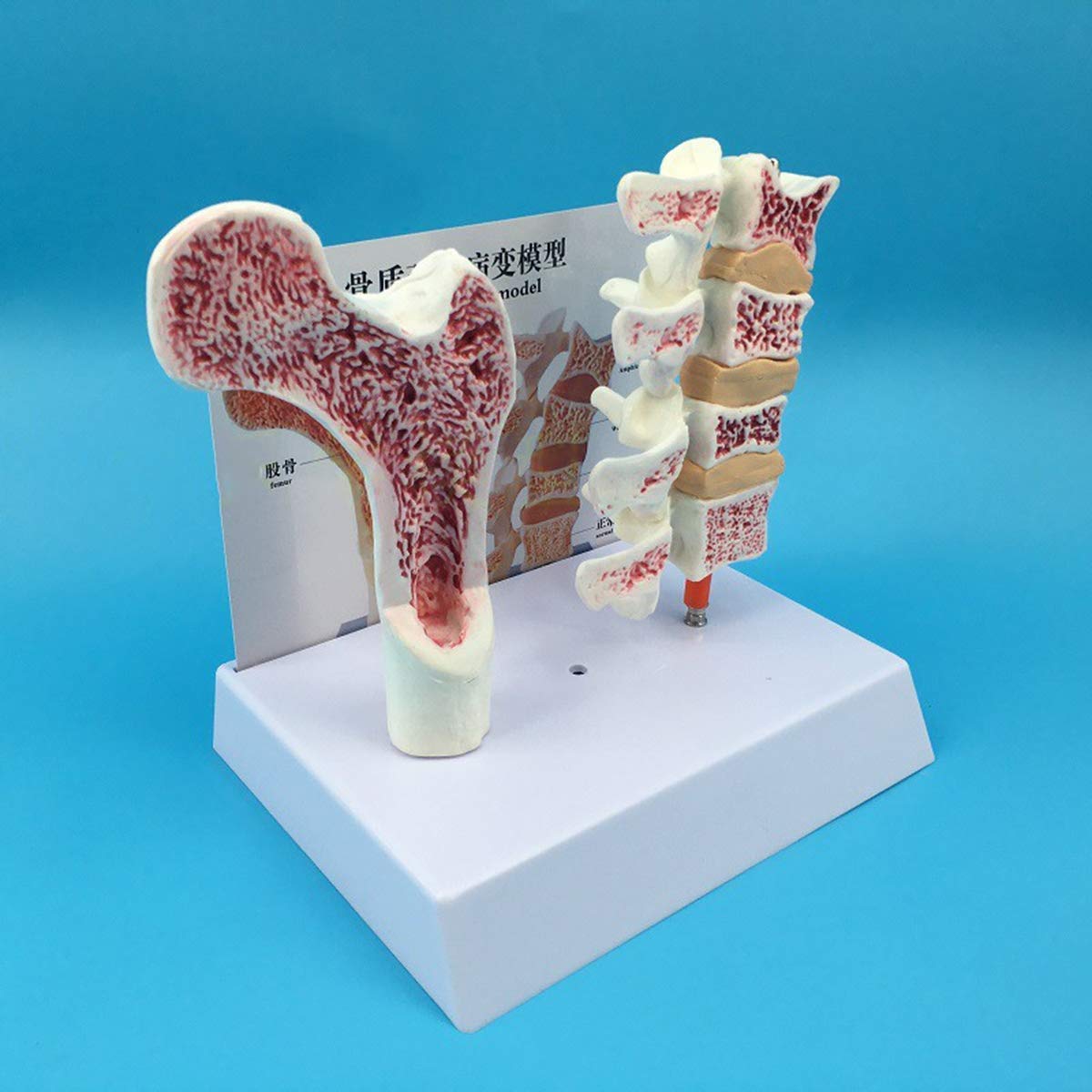 Amazon.co.jp: 等身大の人間の腰椎大腿骨骨粗鬆症病理学モデル-人間の