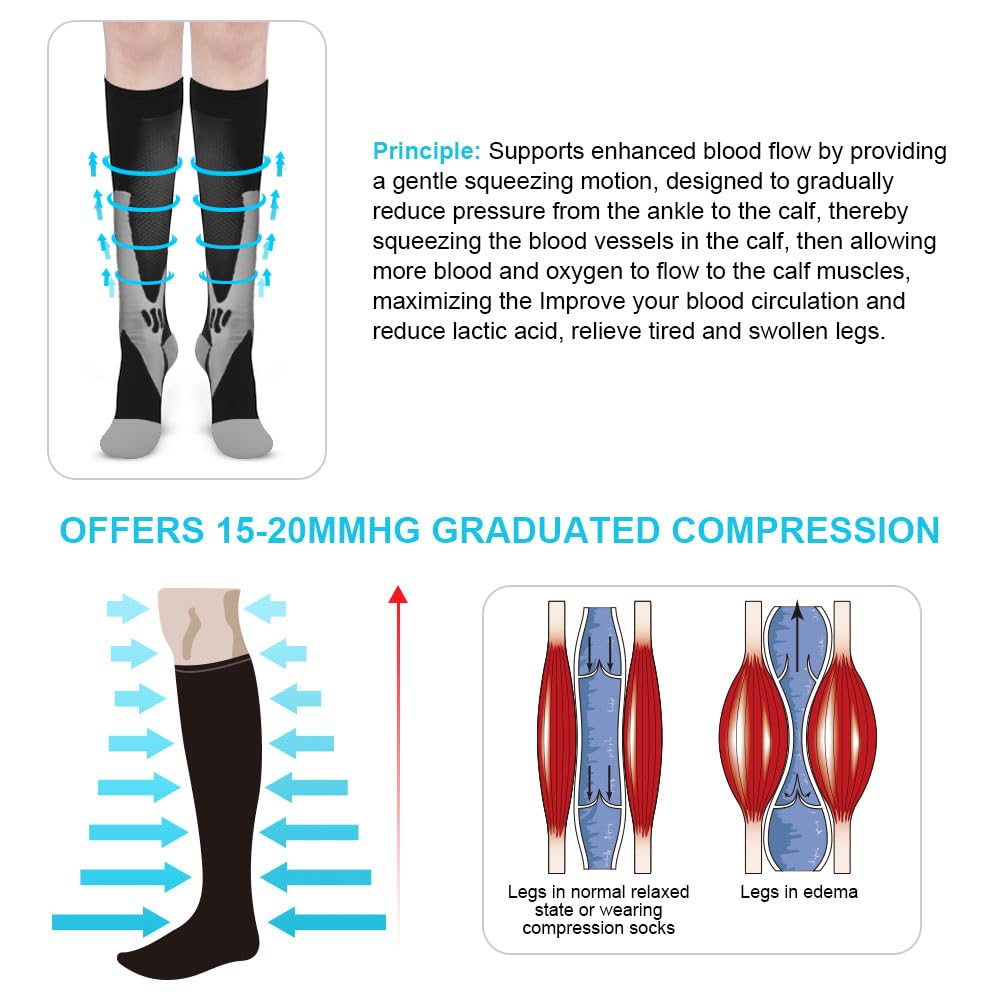 ACWOO Kompressionsstrümpfe Damen und Herren, 2 Paare Kompressionssocken Medizinisch Kompressionsstrümpfe 20-30 mmhg, Thrombosestrümpfe für Sport, Outdoor (S/M, Schwarz/Weiß)