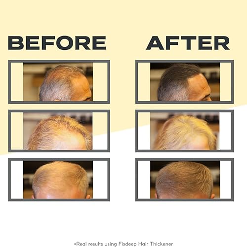 Miniatura 3 de FIXDEEP Espesante de cabello  Nueva fórmula impermeable  Cabello natural y de aspecto más completo en 30 segundos  049oz  Polvo de pérdida de