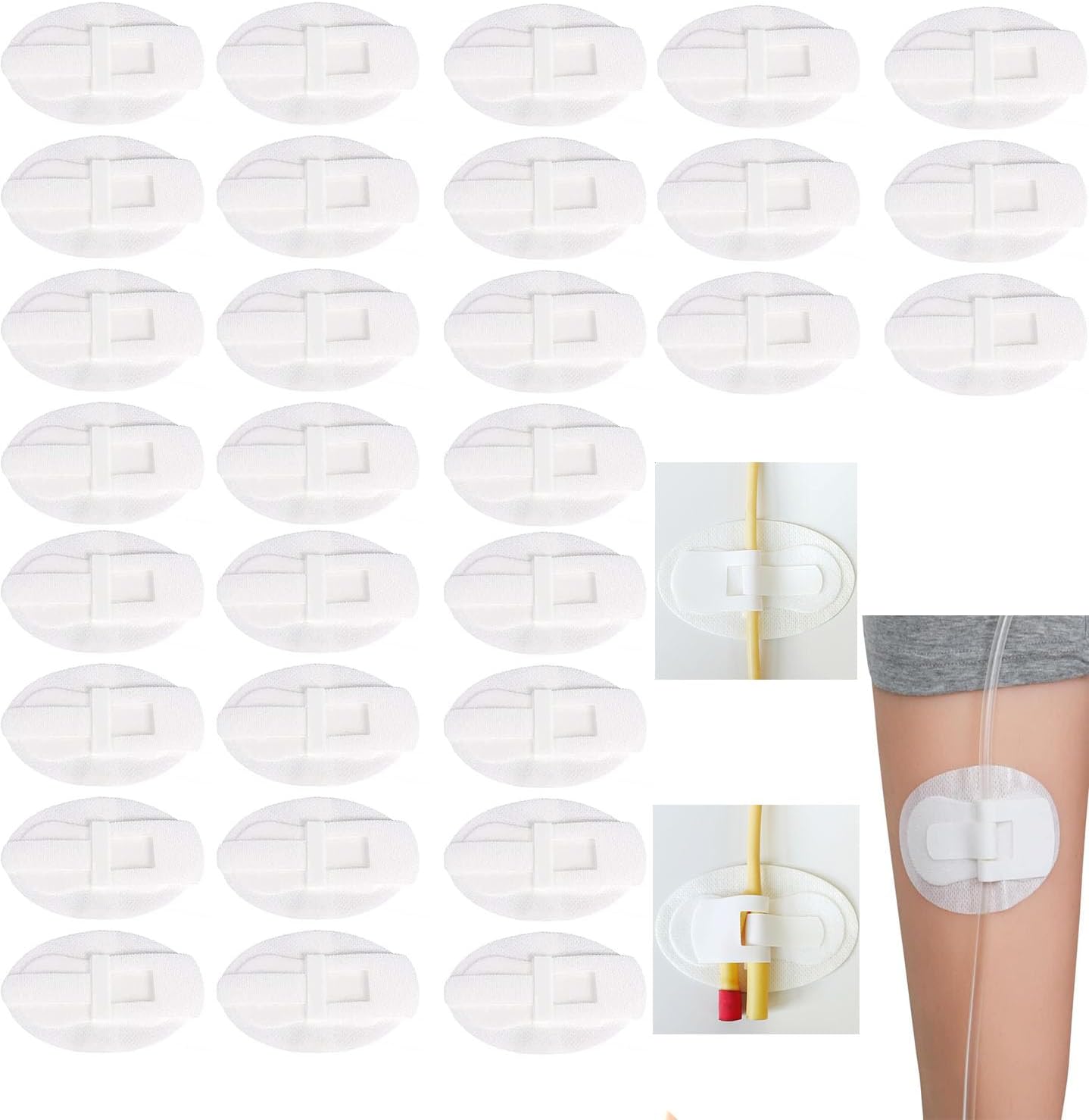 Dispositivo de estabilización de catéter, soporte para bolsa de catéter, soporte de banda para piernas de catéter, adhesivo de fijación de tubo