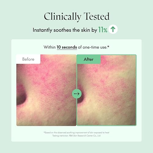 Miniatura 5 de PURITO Seoul Wonder Releaf Centella Toner Centella coreano sin perfume, para pieles sensibles, calmante, tónico facial para cara, K-Beauty, 6.8 fl