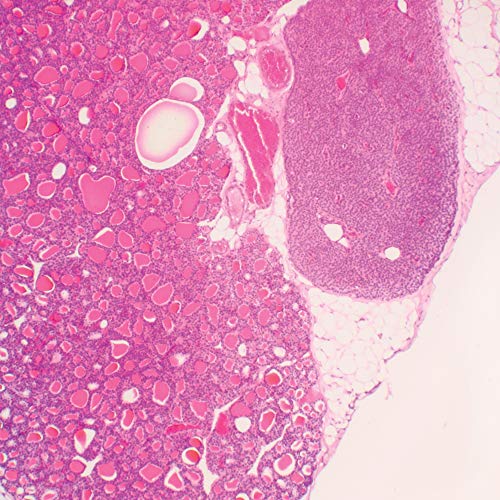 Mammal Thyroid Gland and Parathyroid Gland, sec. 7 m H&E Microscope Slide