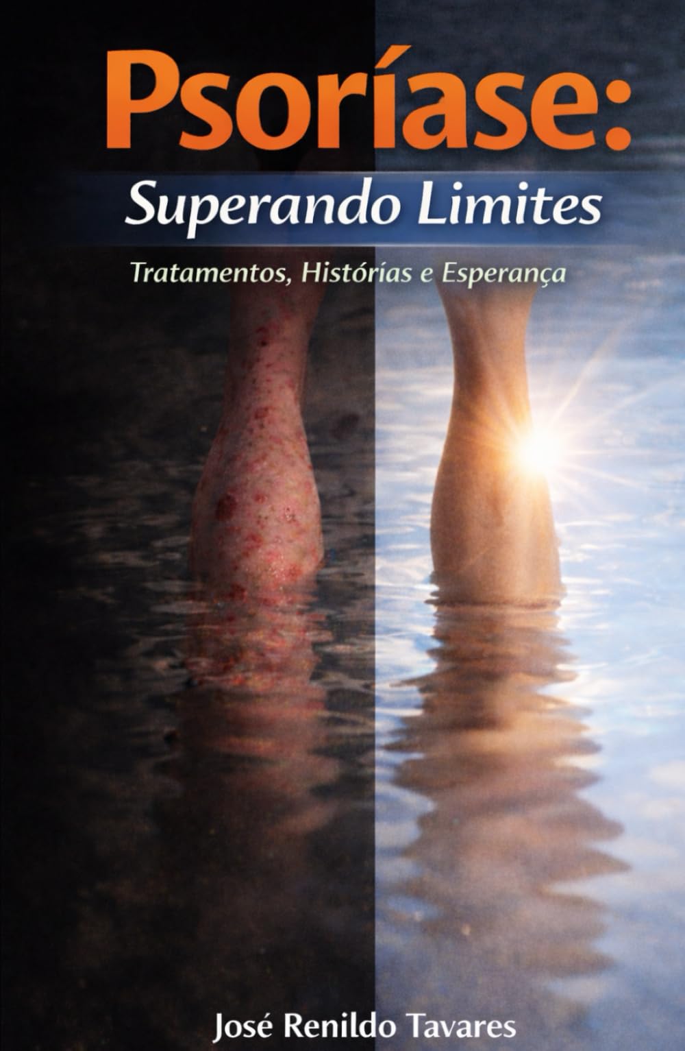PSORÍASE: Superando Limites: Tratamentos, Histórias e Esperança