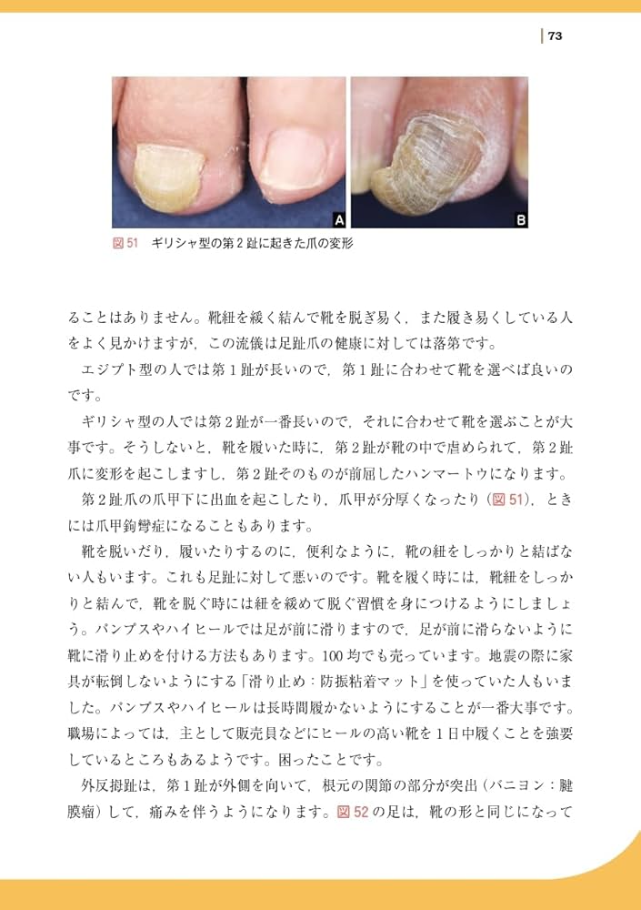 知っておきたい爪の知識と病気: すべての疑問を解決します! | 東