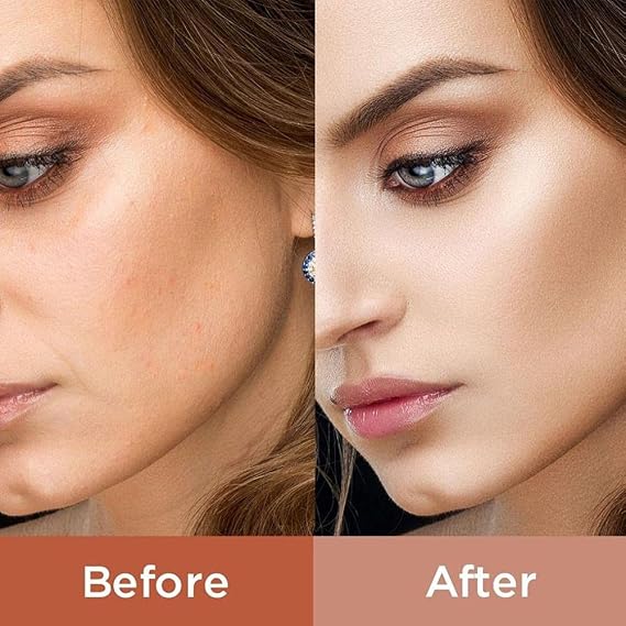 Platinum Lux Instant Face Lift set