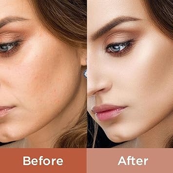 Platinum Lux Instant Face Lift set