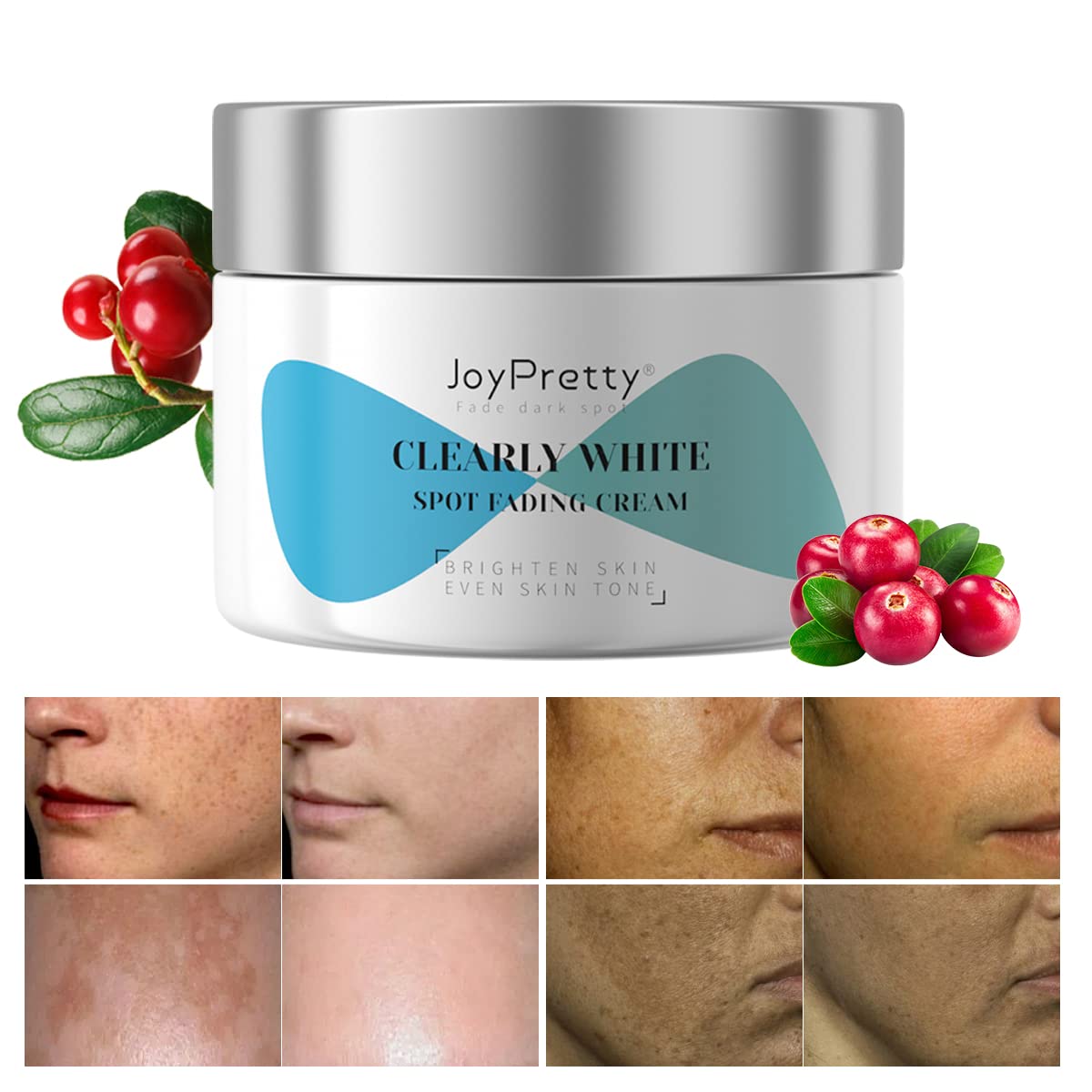 Buy Dark Spot Remover For Face JoyPretty Dark Spot Corrector Sun