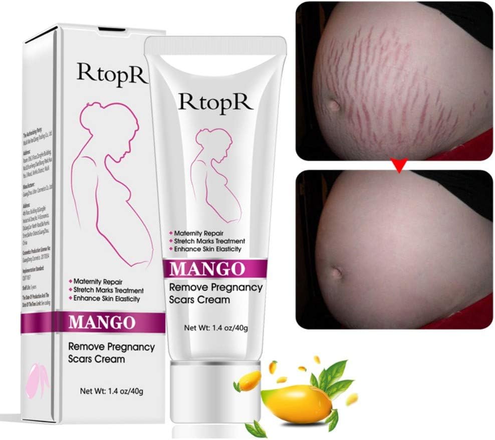 Stretch Mark Scar Cream, Remove Pregnancy Scars,Stretch Marks Treatment, Maternity Repair,Remove Stretch Marks from Pregnancy, Repair Scar Slack Line Abdomen Stretch Marks