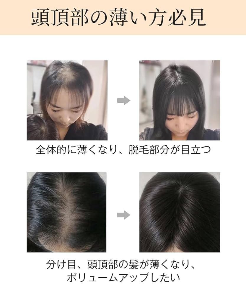 Amazon.co.jp: HIYE 部分ウィッグ 100%人毛 トップカバー 総