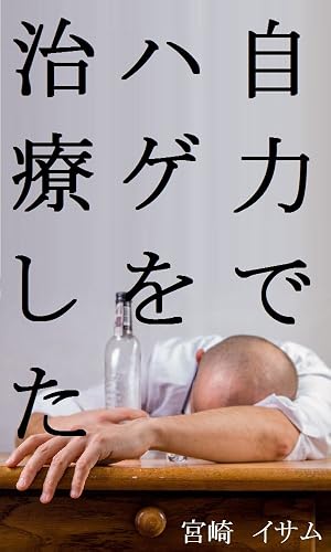 ハゲを治した体験談。ＡＧＡ治療に育毛剤と病院は要らない。