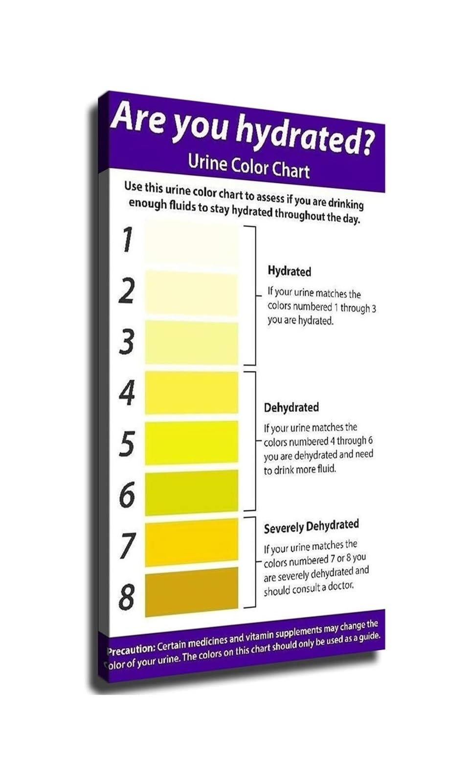 IDGTTLDF Medical Urine Hydration Poster Health Dehydration Check Chart Wall Art Decor For Doctor Office Clinic Framed,12x18inch(30x45cm)