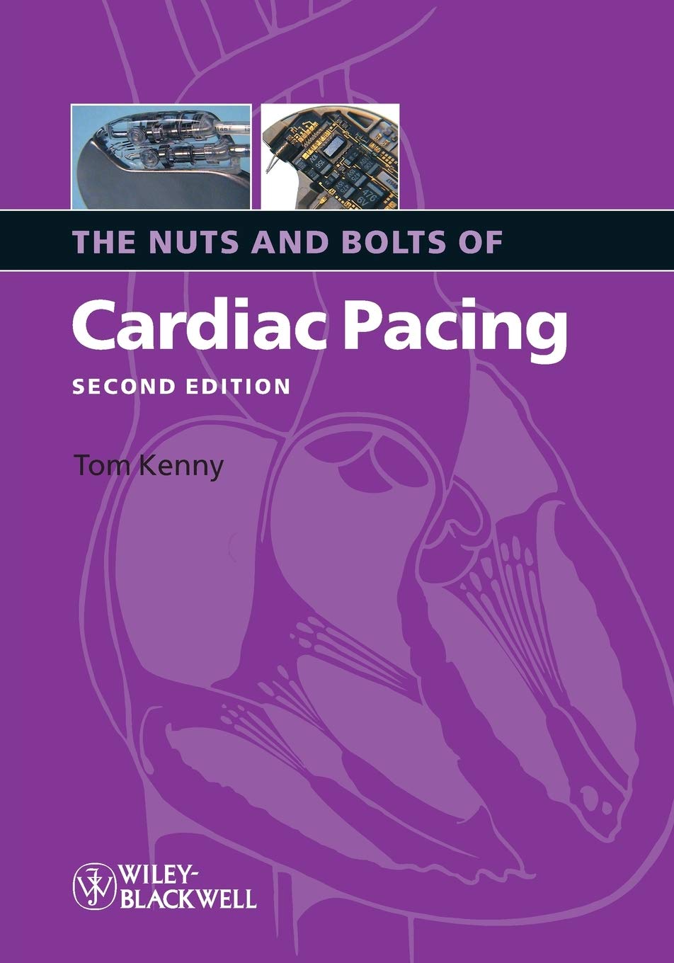 The Nuts and Bolts of Cardiac Pacing (Nuts and Bolts Series) By Tom Kenny