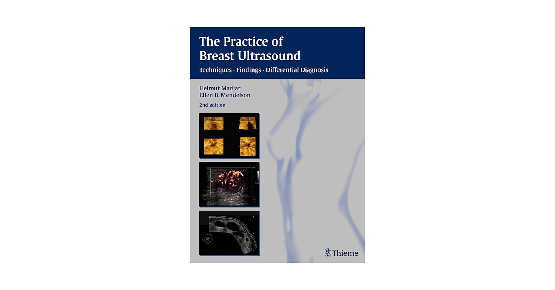 健康・医学 Preneoplasia of the Breast PDF) Preneoplasia of the Breast and Molecular Landscape