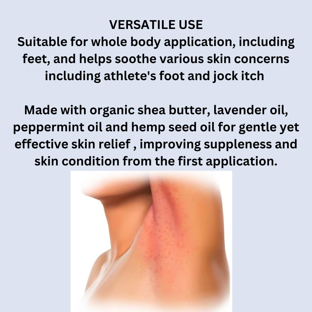 Antifungal Herbal Cream That soothes and relieves. Sweat rash Armpits Groin Jock itch Underboob Gentle Formula Developed by Medical Doctor to Help Your Skin. All Natural - Image 4
