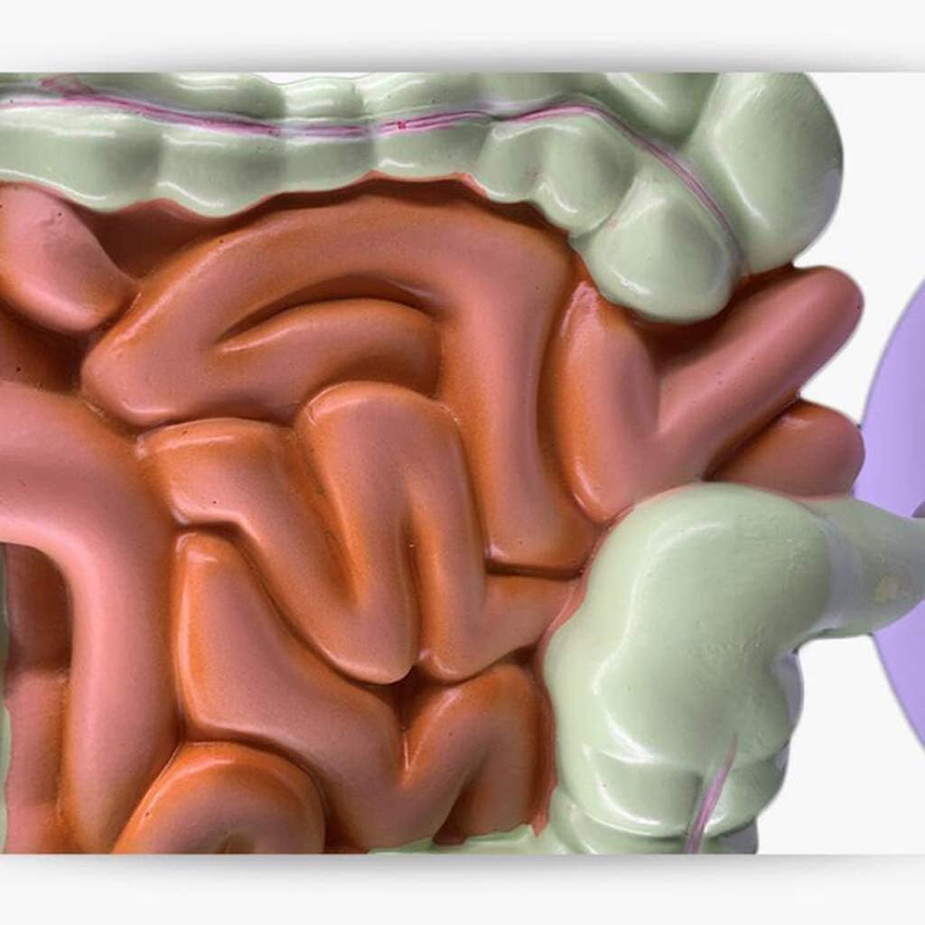 Intestine Model Model Model Colonic Pathology Bowel Thailand | Ubuy