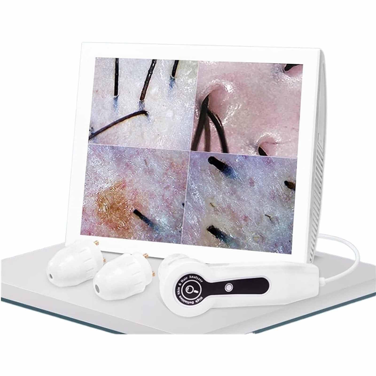 PixCy Analizzatore di Capelli Diagnostico della Pelle, Schermo LCD HD da 15", Scanner della Pelle del Viso, Tester Portatile dei Capelli della Pelle, per Saloni Domestici