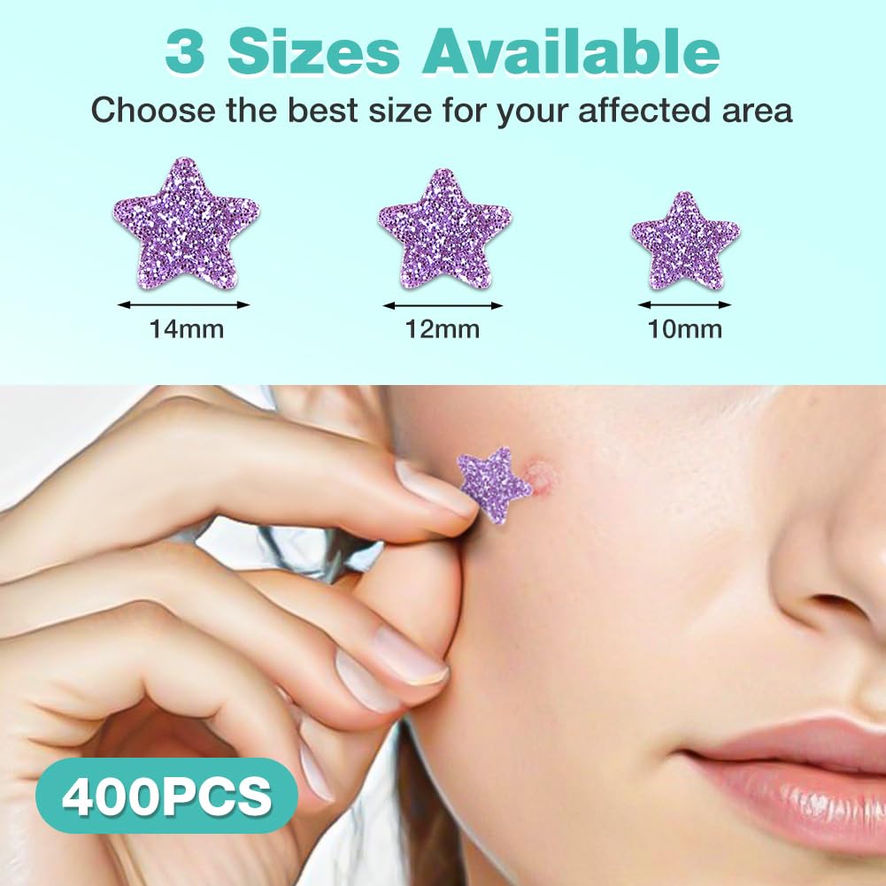 BUTBU Pimple Patches, 400 Pieces Star Hydrocolloid Spot Patches, Mighty Blemish Patches - Image 2