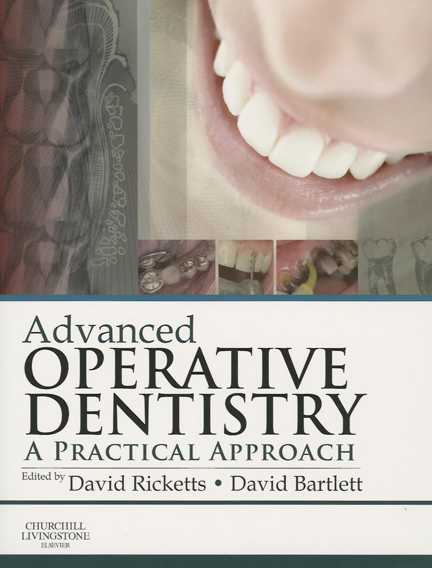 Advanced Operative Dentistry: A Practical Approach