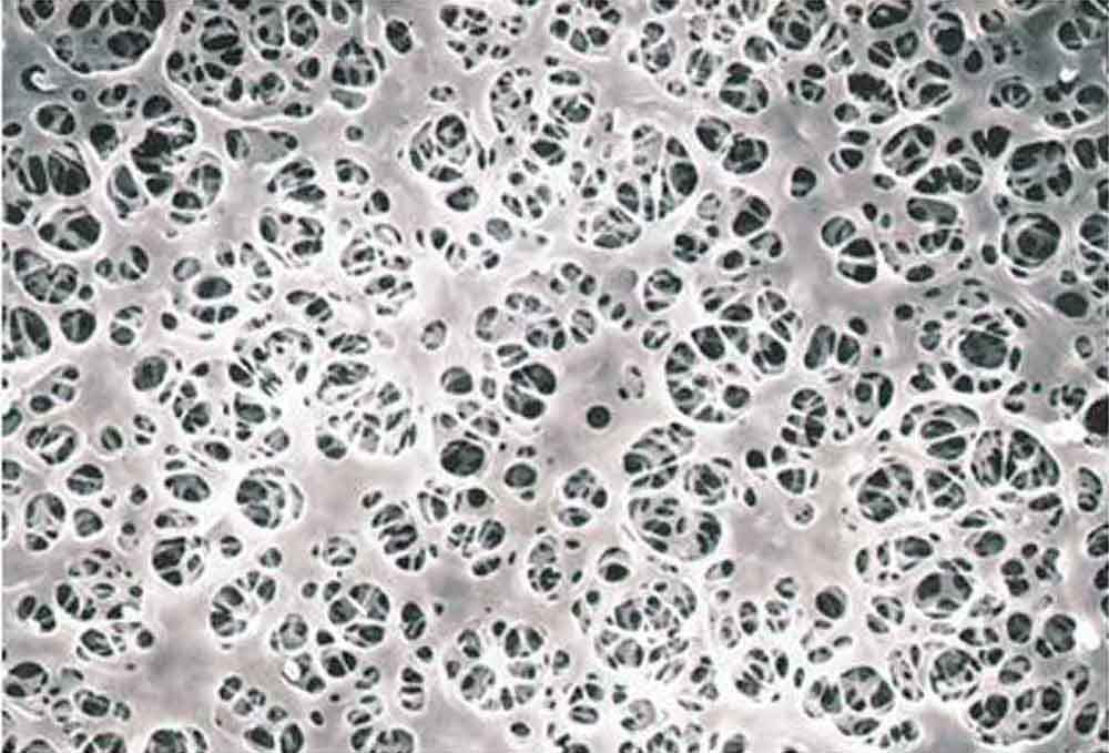 Advantec MFS Y020A035A Coated Cellulose Acetate Membrane Filter, 35 mm Diameter (Pack of 100)