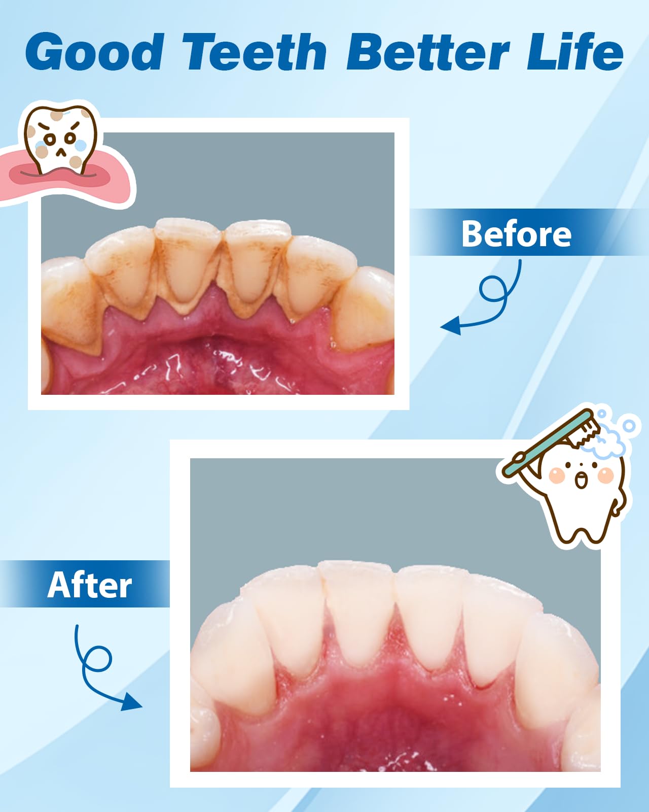 Kit Pulizia Denti Tartaro, Kit Pulizia Denti Animali Domestici, 5 modalità di Spazzolino Denti Cane, Pulizia Denti tartaro con 4 Teste Intercambiabili Per Spazzolare il Tartaro da Persone e Animali