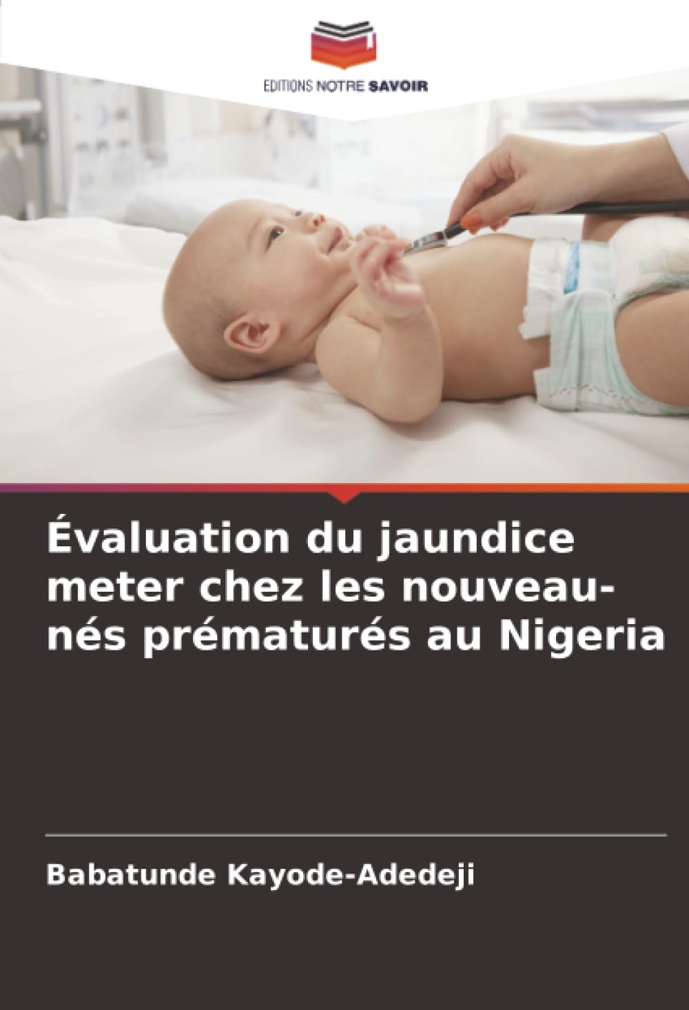 Évaluation du jaundice meter chez les nouveau-nés prématurés au Nigeria