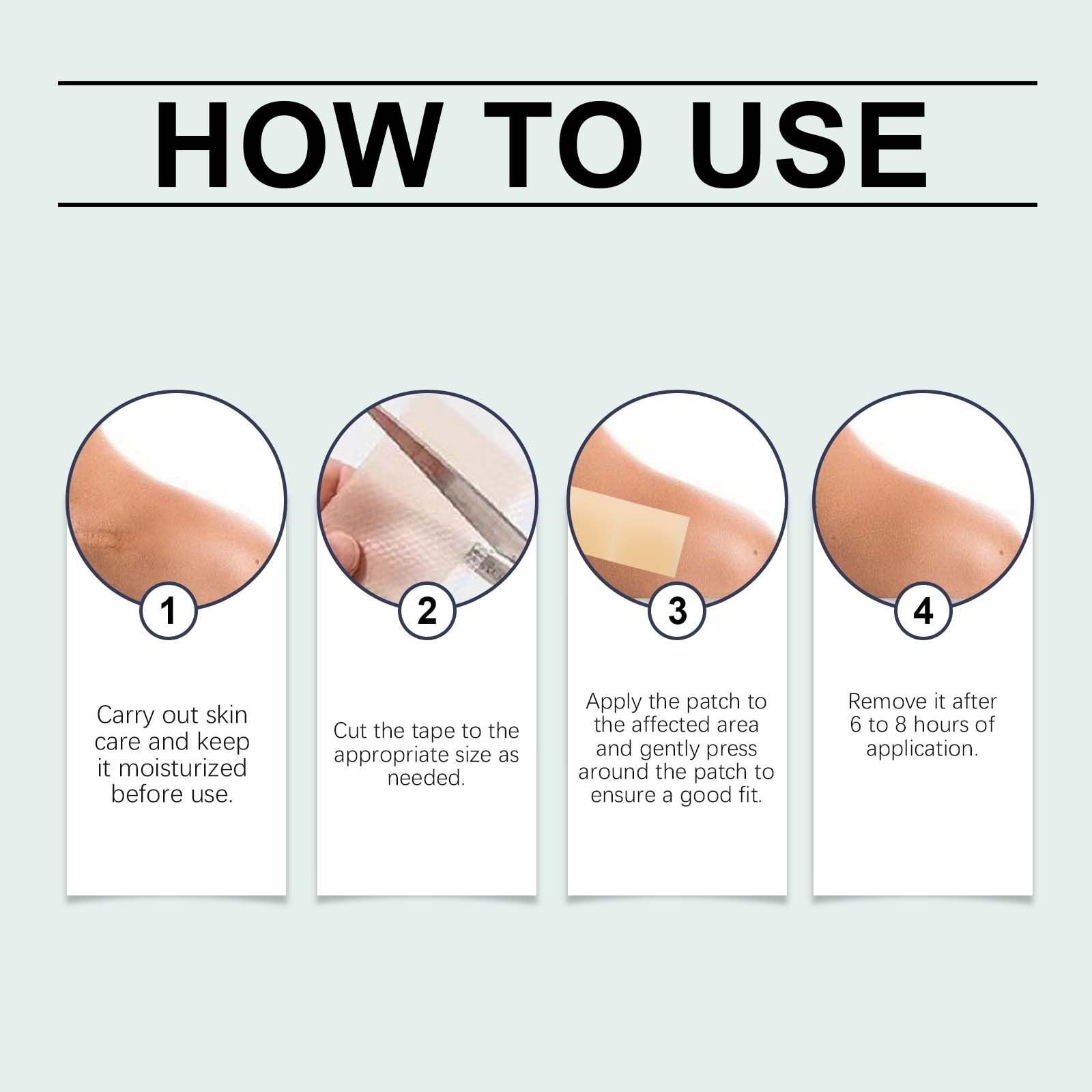 Foglie di cicatrice in silicone medico per la cura della pelle di bellezza tagliabili, con collagene, impermeabili fogli medici per taglio cesareo e cheloidi, traspiranti, Imper