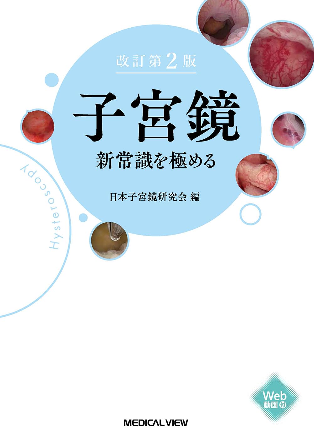 子宮鏡 新常識を極める−改訂第2版 | 日本子宮鏡研究会 |本 | 通販