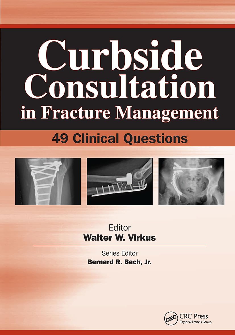 Buy Curbside Consultation in Fracture Management — BookShops.in