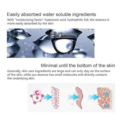 Miniatura 2 de Suero facial de niacinamida para cara y piel, suero facial hidratante para acné, manchas oscuras, poros, líneas finas