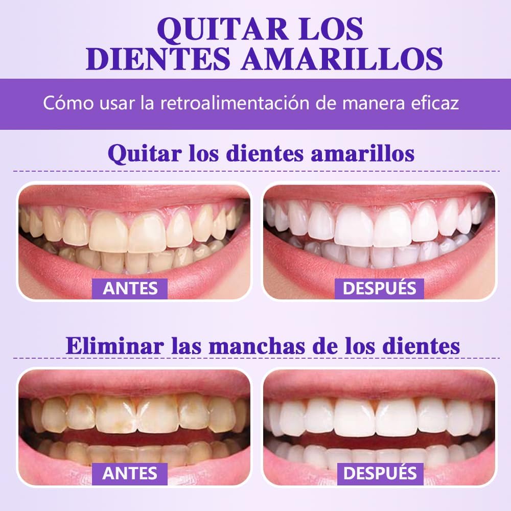 Professional Teeth Whitener Powder | Removes Years of Coffee & Tobacco Stains | Gentle Formula for Sensitive Teeth | Obsessive Whitening for Radiant Smile & Fresh Breath — view 5