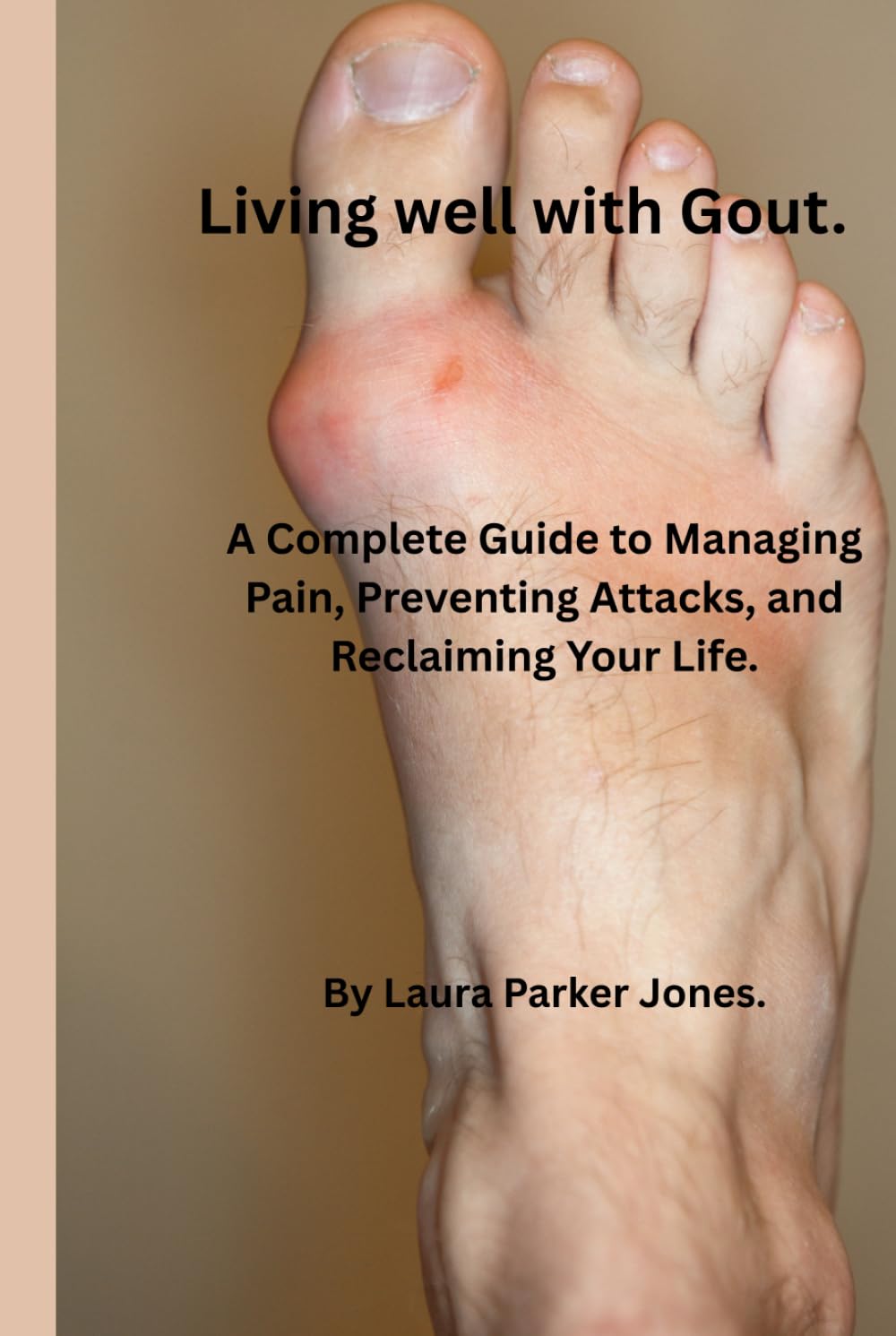 Living Well with Gout.: A Complete Guide to Managing Pain, Preventing Attacks, and Reclaiming Your Life. (How to live a better life with arthritis)
