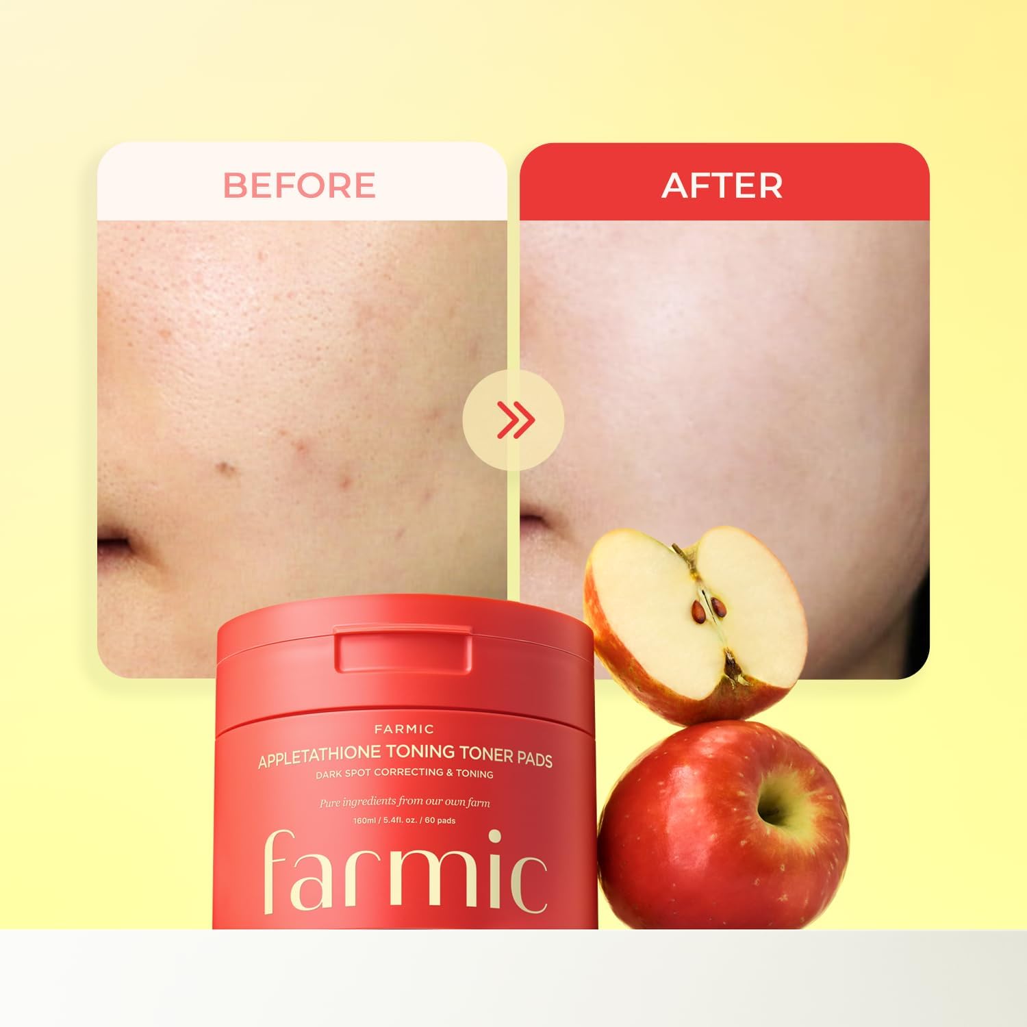 Appletathione Toning Toner Pads for Dark Spots & Uneven Tone Refinement with Apple+Glutathione, Niacinamide, LHA & PHA, 160ml/5.41fl.oz./60 Pads