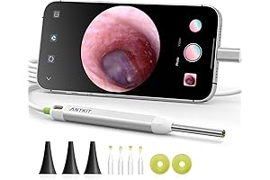 Anykit Earwax Removal Tool with Built-In Camera