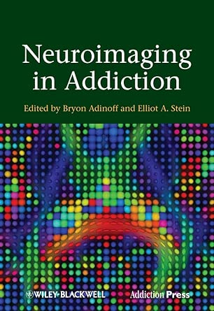 Neuroimaging in Addiction book cover