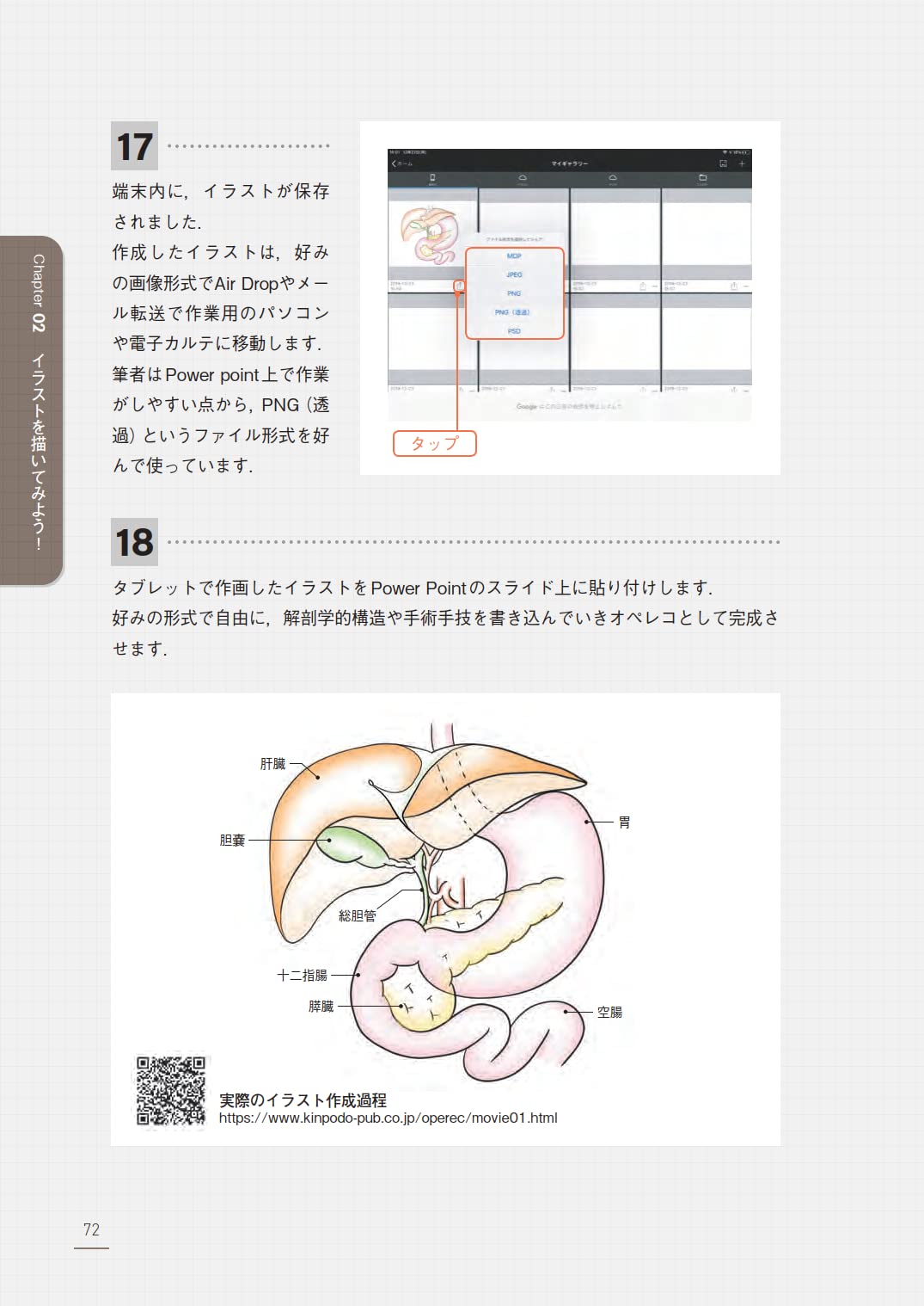 伝わる 真似できる 手術記録の描き方 活かし方 デジタルイラストで描くオペレコ入門 すぐに使えるイラストパーツ Web動画付 楳田 祐三 本 通販 Amazon 伝わる 真似できる 手術記録の描き方 活かし方 デジタルイラストで描くオペレコ入門 すぐに使えるイラストパーツ Web動画付 楳田 祐三 本 通販 Amazon