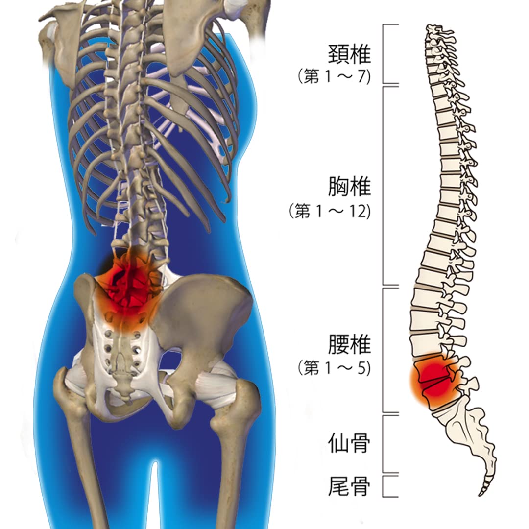 Amazon | 【サイプラス】ドクターコツアーチ 腰椎コルセット（M
