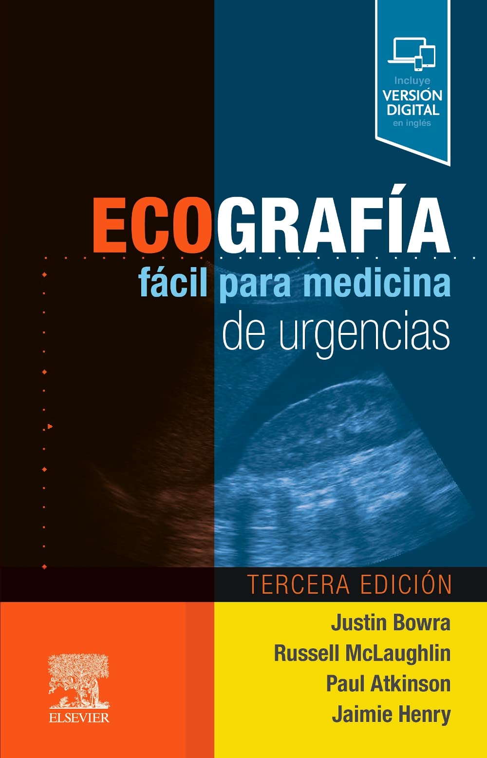 Ecografía fácil para medicina de urgencias
