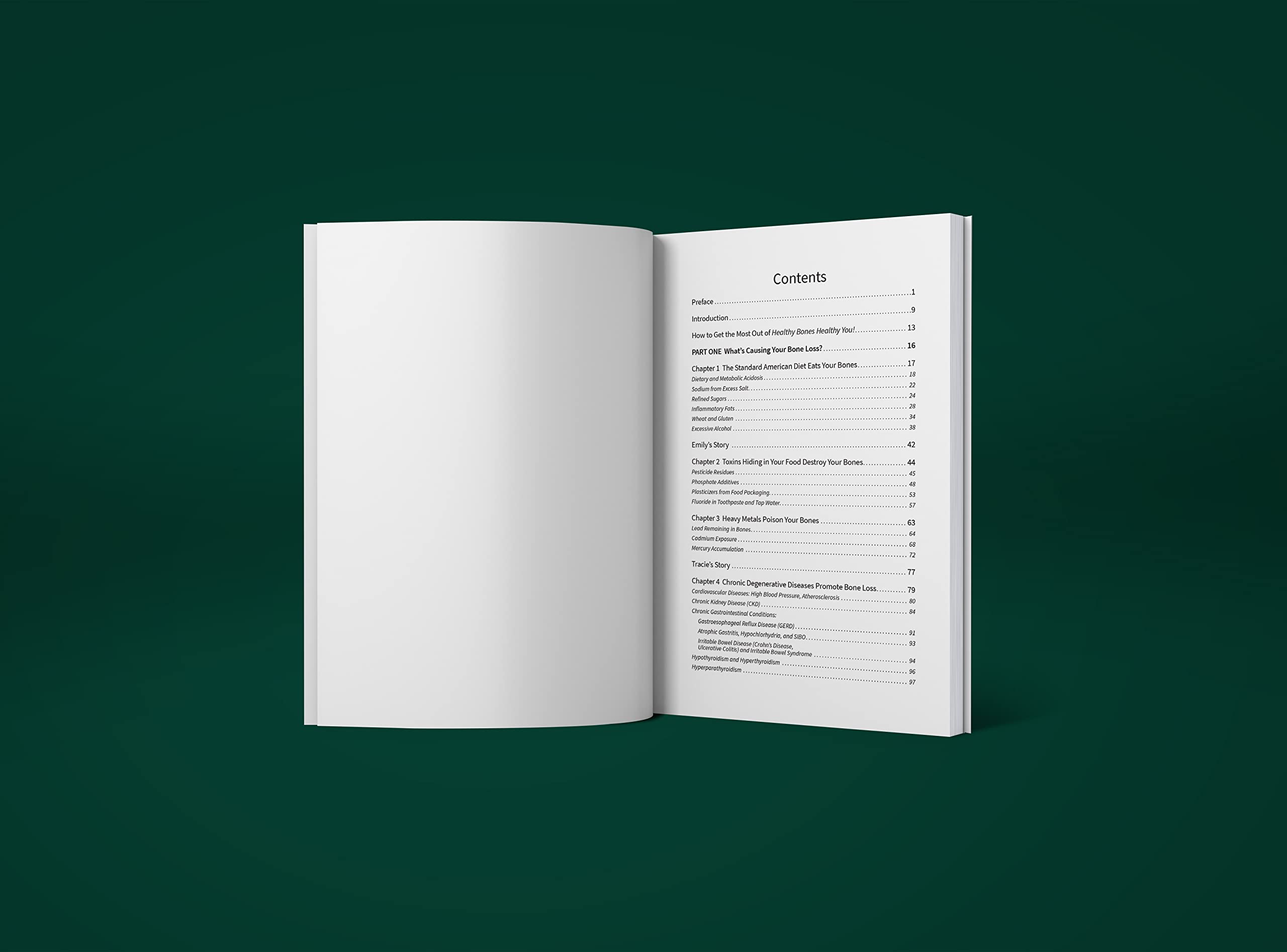 Des os sains pour vous en bonne santé - Construisez naturellement des os forts et vibrants pour réécrire votre histoire de vieillissement et vivre sans limites. Guide sur la façon de prévenir
