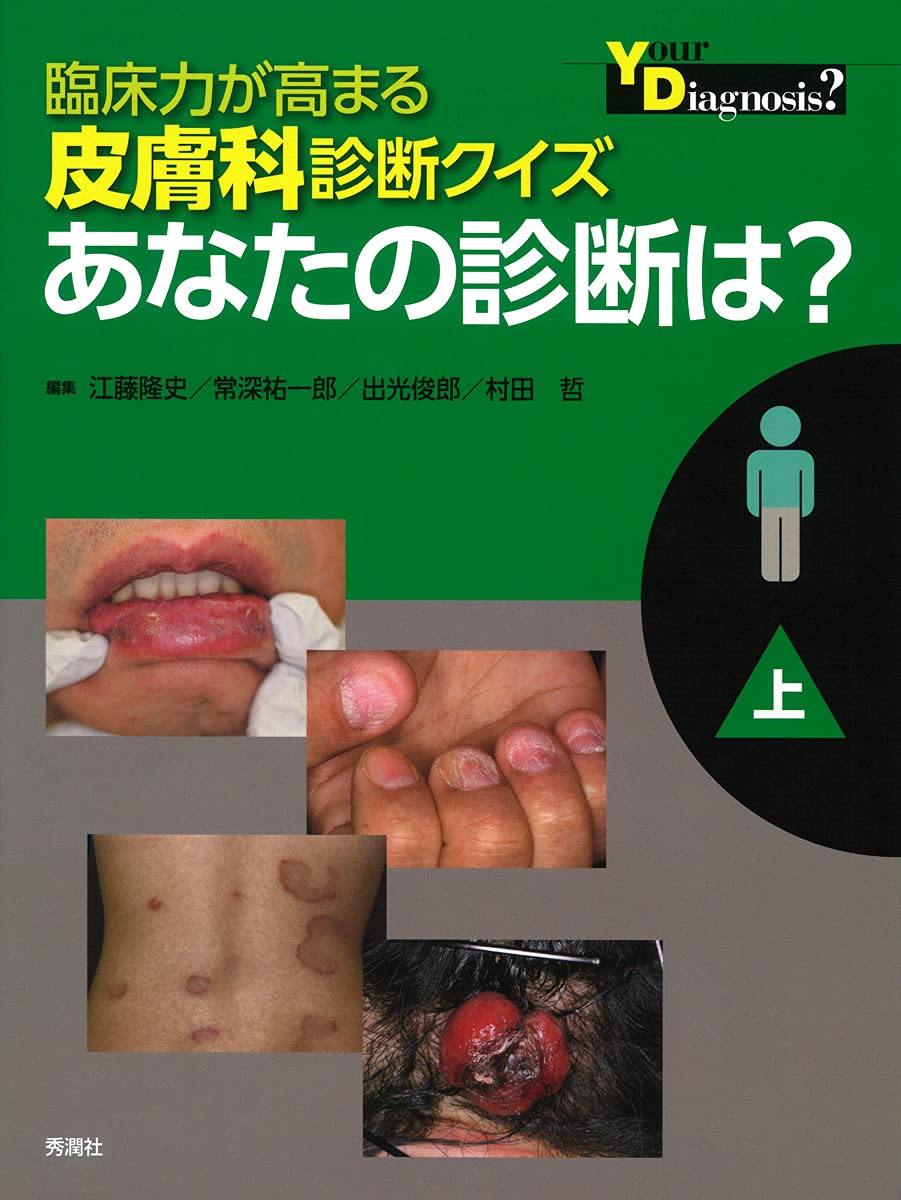 Amazon.co.jp: 臨床力が高まる皮膚科診断クイズ 上 : 江藤隆史, 常深
