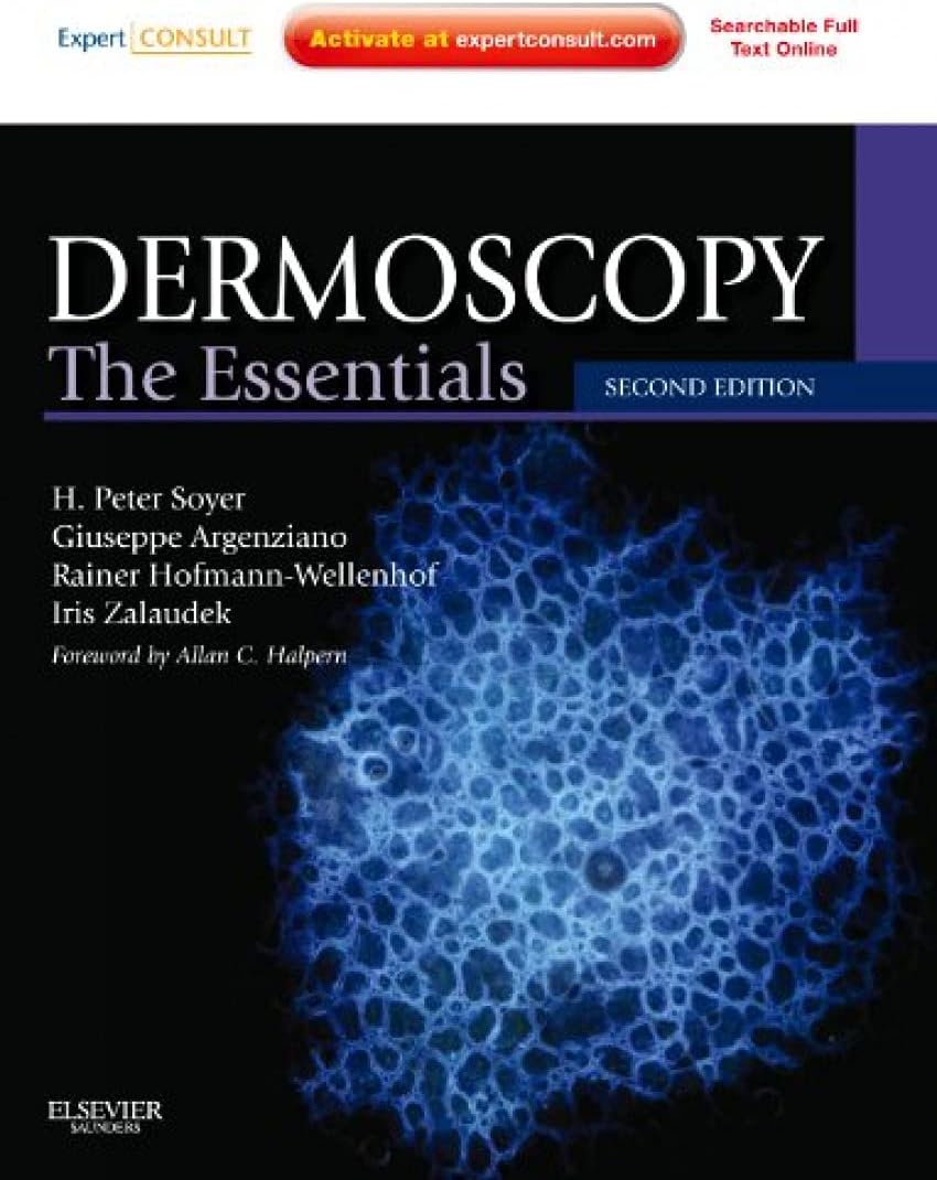 Dermoscopy: The Essentials: Expert Consult - Online and Print 2nd Edition