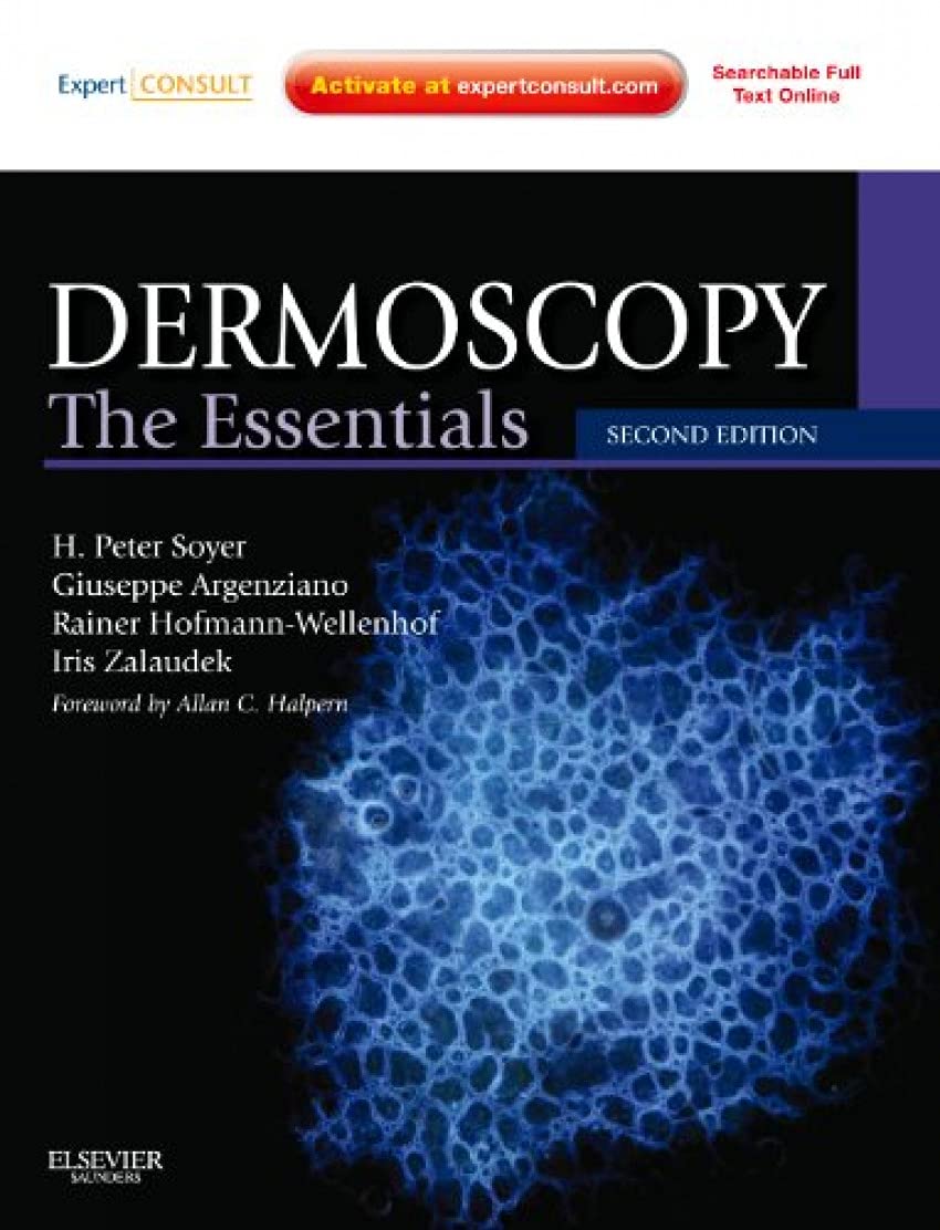 Dermoscopy: The Essentials: Expert Consult - Online and Print 2nd Edition