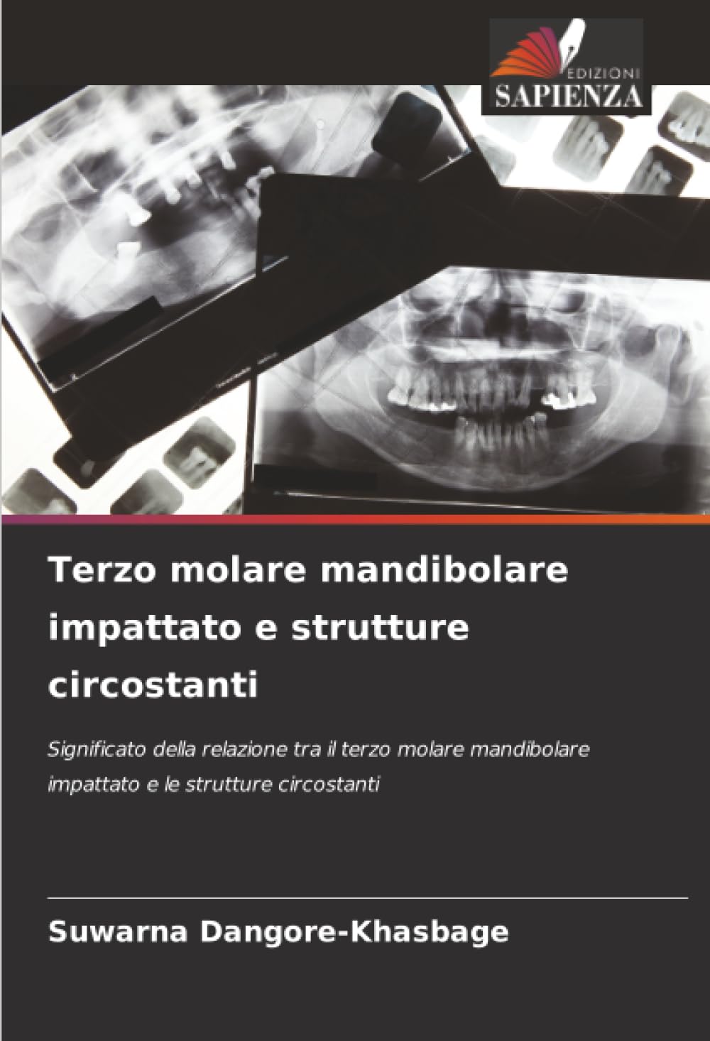 Terzo molare mandibolare impattato e strutture circostanti: Significato della relazione tra il terzo molare mandibolare impattato e le strutture circostanti
