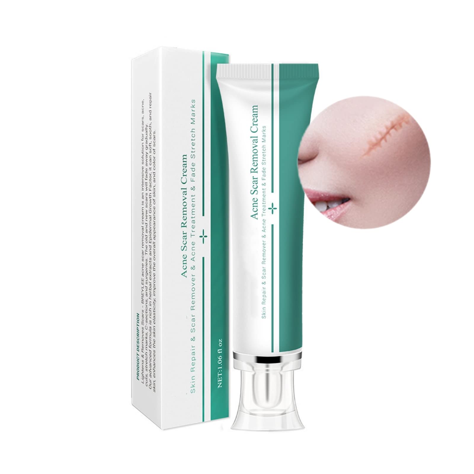 Acne Scar Removal Cream Scar Repair Cream Herbal Repair Cream Fade Scars & Acne Marks Skin Care Repair Gel, Improve All Skin, Replenish Moisture & Nutrients Moisturizes Skin 30ml