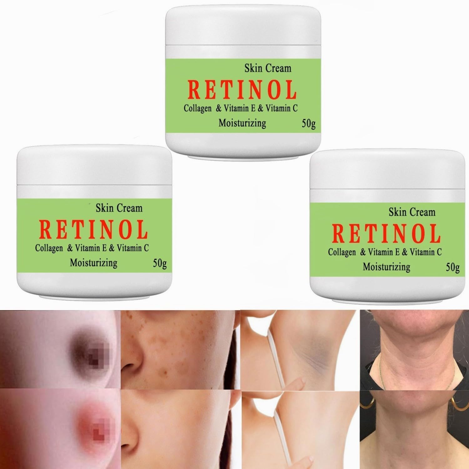 Cremas Para Las Manchas de La Cara, 50g Vitamin C&E Face Moisturizer Cream, Adecuado para varias áreas como cara, axilas, cuello, zona privade (3pcs)