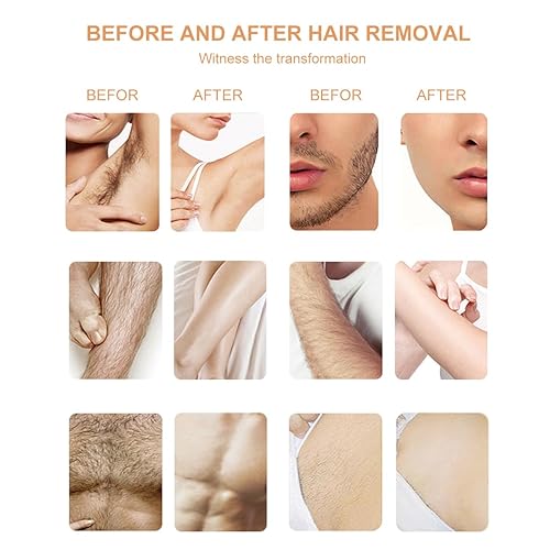 Miniatura 3 de YOUNG VISION Perlas de cera dura sin colofonia para depilación  35.27 oz (2.2 libras), paquete de granos de cera dura de 10 colores, perlas de cera