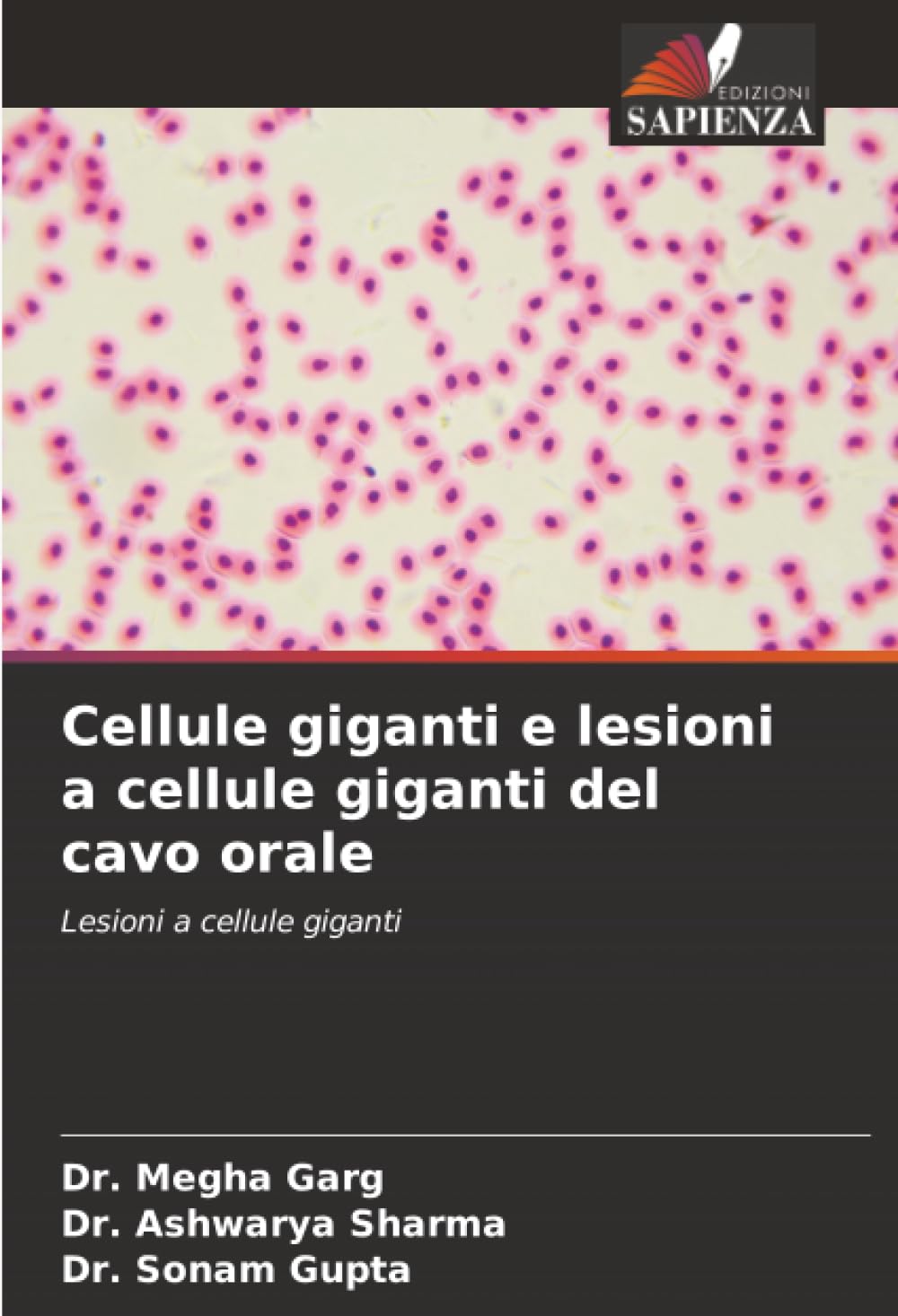 Cellule giganti e lesioni a cellule giganti del cavo orale: Lesioni a cellule giganti
