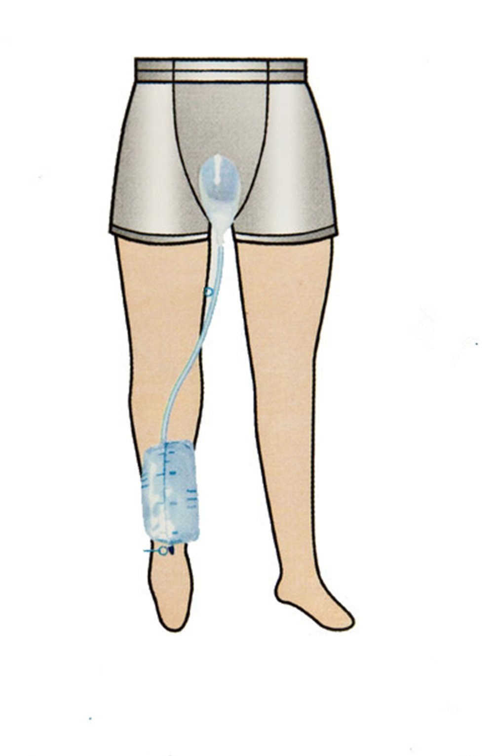 Collecteur D'urine Pour Homme, 1,5L, Sans étui Pénien - Idéal En Cas D'incontinence Ou De Fuites Urinaires