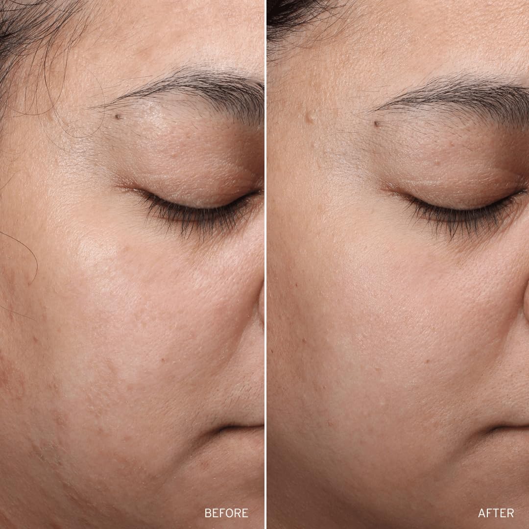 Aramore NAD+ Cell Restoration Cream, Clinically Proven Moisturizer Face Cream, Vegan, Hypoallergenic, Fragrance-Free Face Cream (50ml) - Image 7